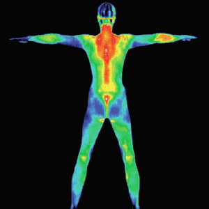 Full Body Thermography Scan