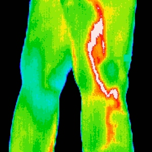 Thermography - region of interest scan