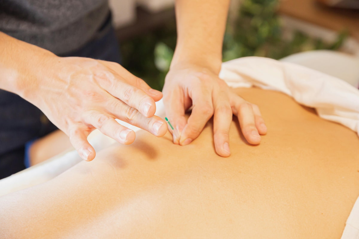 Therapist treating patient with needles during procedure of alternative medicine