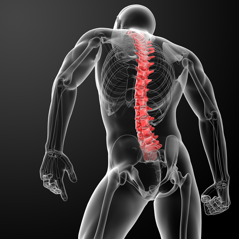Diagram with highlighted spinal pain
