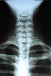 Chiropractic x-rays