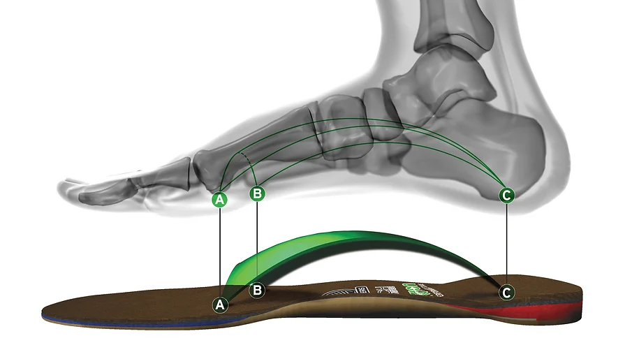 plantar-vault.webp