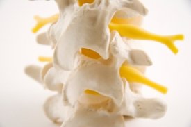Chiro chiropractor provides treatment for herniated discs and shoulder pain