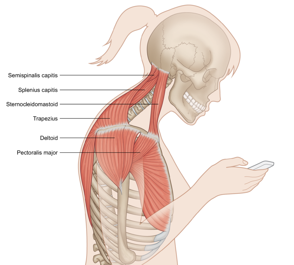 neck pain, low back pain, headache, forward head posture, text neck 