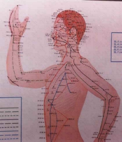 Acupuncture