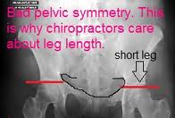 short_leg_xray.jpg