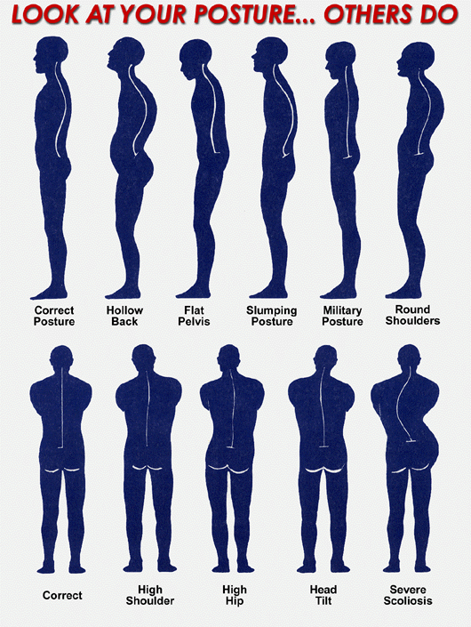 posture4.gif