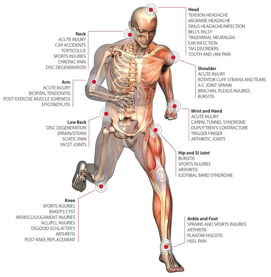 chiropractic-treatment-skeleton-laser