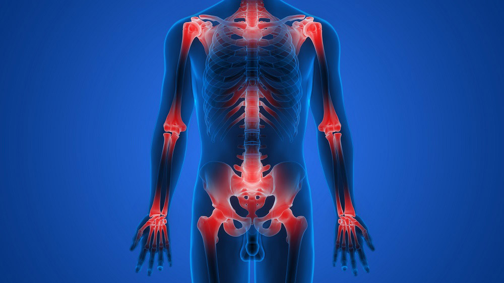 joint pain illustration
