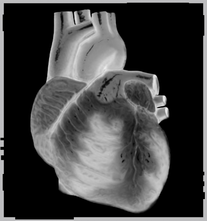 digital imaging of a heart at the Joplin chiropractic office