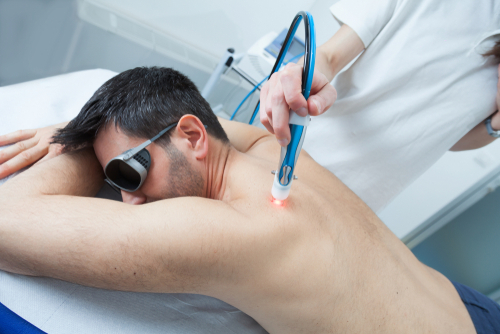 PBM laser therapy applied to lower back for pain relief