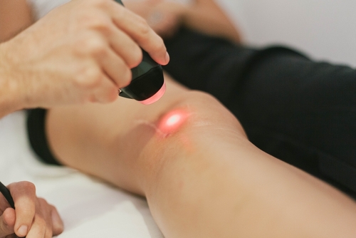 PBM laser therapy applied to knee for pain relief and healing