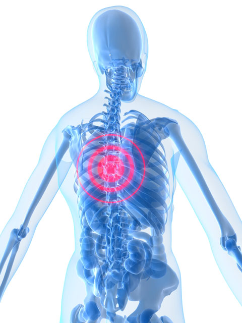 Illustration with mid back pain Illustration with mid back pain