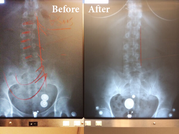 Active Therapeutic Movement